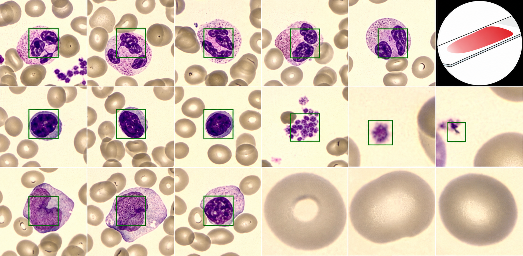 Hospital quality whole blood images.